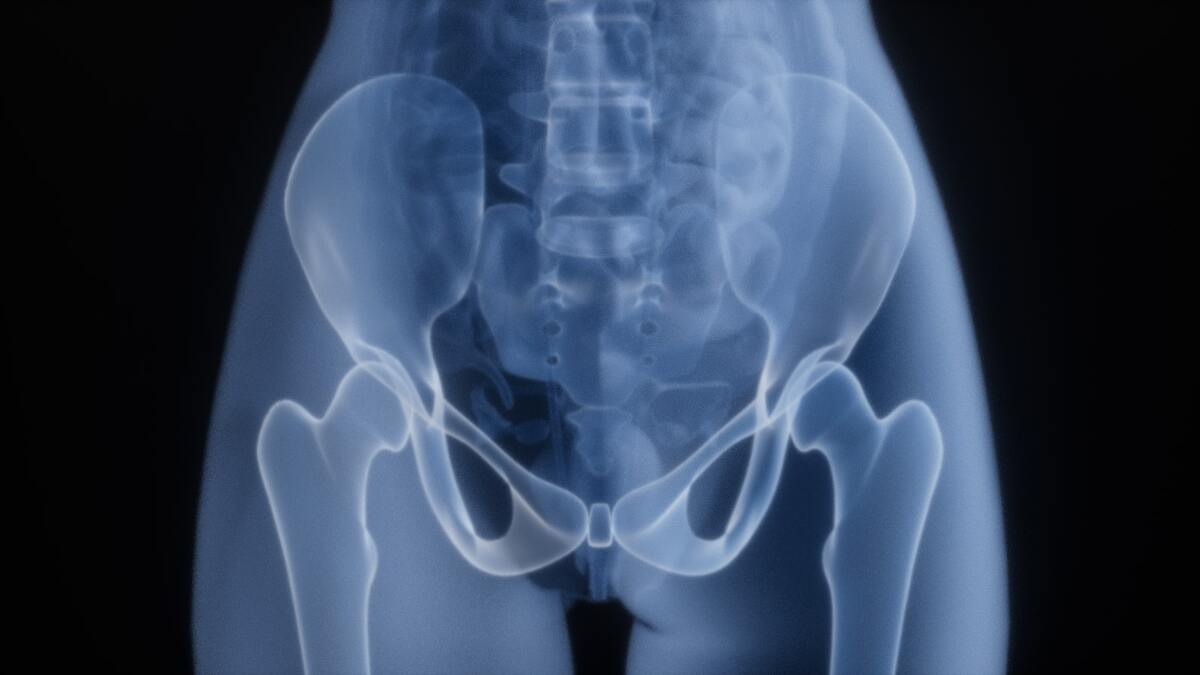 Hip Bursitis: Lasting Relief for Stubborn Outer-Hip Pain — Westlake, OH Hip Bursitis: Lasting Relief for Stubborn Outer-Hip Pain — Westlake, OH